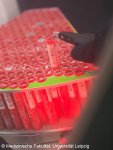 Proben in der LIFE-Biobank